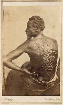 Blog_atlantic_gordon Photo of back of an African American man, his back swelled with wounds from a whip