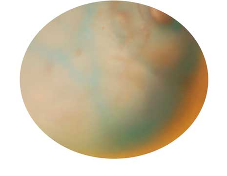 Close-up painting of skin, showing veins