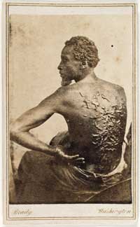 Blog_freedoms_light_gordon Photograph portrait of Gordon, his back turned towards camera and full of scars from whip lashing