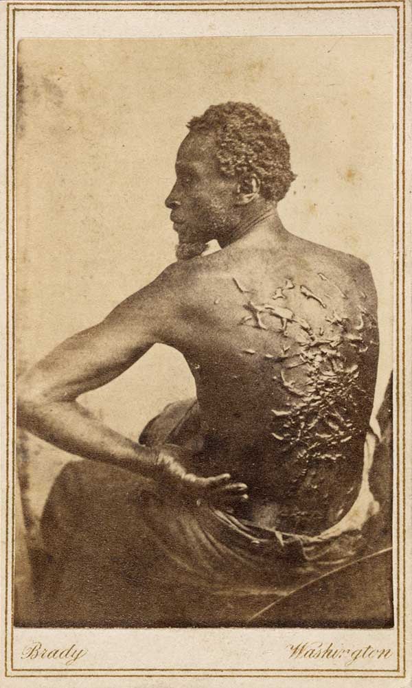 Photograph portrait of a slave named Gordon, his back towards camera and full of raised, spider-web-like scars from whipping