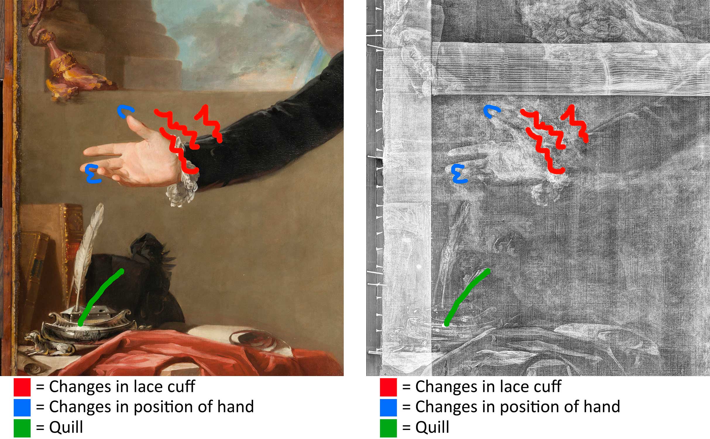 Black and white images of a man's hand with annotations pointing out different changes